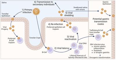 The viral etiology of EBV-associated gastric cancers contributes to their unique pathology, clinical outcomes, treatment responses and immune landscape